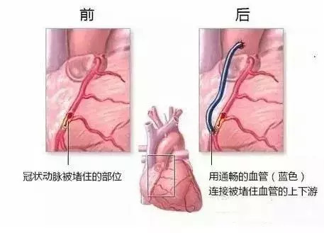 通草的功效与作用能通输卵管堵塞,可持续发展探索_潮流版16.932