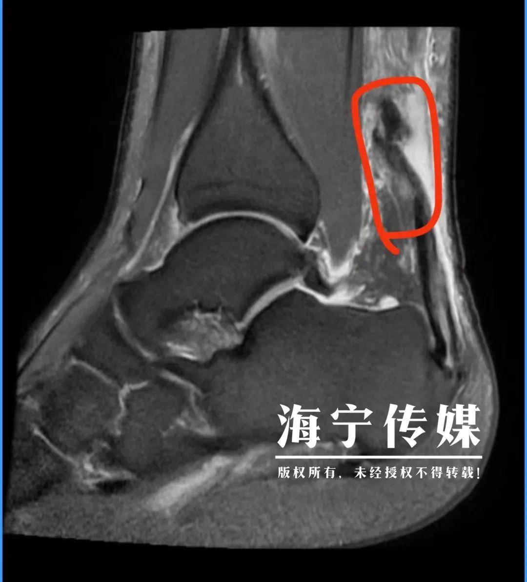 海宁市康复事业单位最新项目，重塑生活的希望之光，提升生活质量